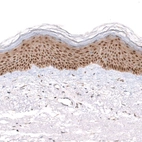 Immunohistochemical staining of human skin shows strong cytoplasmic and nuclear positivity in squamous epithelial cells.