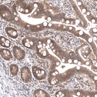 Immunohistochemical staining of human small intestine shows strong cytoplasmic positivity in glandular cells.