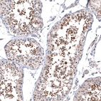 Immunohistochemical staining of human testis shows strong cytoplasmic positivity in cells in seminiferous ducts.