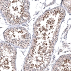 Immunohistochemical staining of human testis shows strong cytoplasmic positivity in cells in seminiferous ducts.