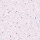 Immunohistochemical staining of human skeletal muscle shows no positivity in myocytes as expected.