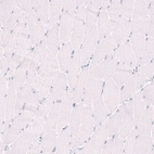 Immunohistochemical staining of human skeletal muscle shows no positivity in myocytes as expected.