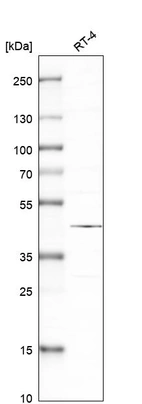 Western blot analysis in human cell line RT-4.