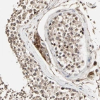 Immunohistochemical staining of human testis shows moderate cytoplasmic positivity in Leydig cells.