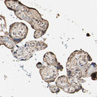 Immunohistochemical staining of human placenta shows moderate cytoplasmic positivity in trophoblastic cells.