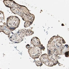 Immunohistochemical staining of human placenta shows moderate cytoplasmic positivity in trophoblastic cells.