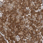Anti-AUP1 Antibody