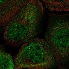 Anti-C3orf52 Antibody