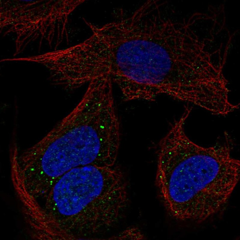 Anti-PCDHB14 Antibody