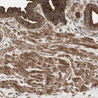 Immunohistochemical staining of human prostate shows strong cytoplasmic positivity in smooth muscle and glandular cells.