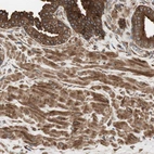Immunohistochemical staining of human prostate shows strong cytoplasmic positivity in smooth muscle and glandular cells.