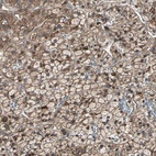 Anti-GNAI2 Antibody