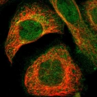 Immunofluorescent staining of human cell line A-431 shows localization to nucleoplasm, plasma membrane & cytosol.
