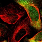 Immunofluorescent staining of human cell line U-2 OS shows localization to nucleoplasm, cytosol & vesicles.