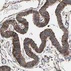 Immunohistochemical staining of human fallopian tube shows moderate cytoplasmic positivity in glandular cells.