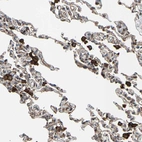 Immunohistochemical staining of human lung shows strong cytoplasmic positivity in macrophages.