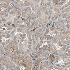 Immunohistochemical staining of human kidney shows weak cytoplasmic positivity in cells in tubules.