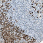 Immunohistochemical staining of human tonsil shows strong cytoplasmic positivity in germinal and non-germinal center cells.