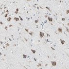 Immunohistochemical staining of human cerebral cortex shows strong cytoplasmic positivity in neurons.