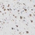 Immunohistochemical staining of human cerebral cortex shows strong cytoplasmic positivity in neurons.