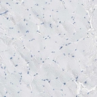 Immunohistochemical staining of human skeletal muscle shows no positivity in myocytes as expected.