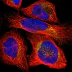 Immunofluorescent staining of human cell line U-2 OS shows localization to cytosol.