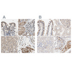 Anti-PROS1 Antibody