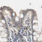 Immunohistochemical staining of human colon using Anti-PROS1 antibody HPA007724.