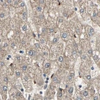 Immunohistochemical staining of human liver using Anti-PROS1 antibody HPA007724.