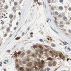 Anti-PROS1 Antibody