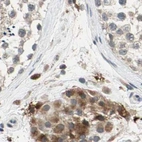 Immunohistochemical staining of human testis using Anti-PROS1 antibody HPA007724.