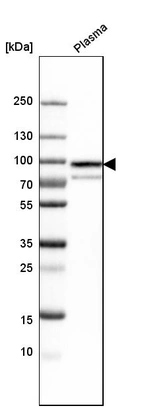 Western blot analysis in human plasma.