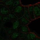 Anti-TBC1D10A Antibody