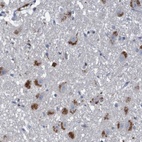 Anti-LTA Antibody