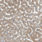 Immunohistochemical staining of human liver shows moderate cytoplasmic positivity in hepatocytes.