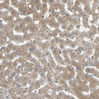 Immunohistochemical staining of human liver shows moderate cytoplasmic positivity in hepatocytes.