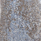 Immunohistochemical staining of human tonsil shows moderate to strong cytoplasmic positivity in non-germinal center cells.