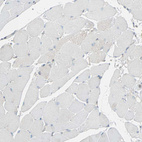 Immunohistochemical staining of human skeletal muscle shows no positivity in myocytes as expected.