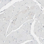 Immunohistochemical staining of human skeletal muscle shows no positivity in myocytes as expected.