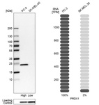 Western blot analysis in human cell lines PC-3 and SK-MEL-30 using Anti-PRDX1 antibody. Corresponding PRDX1 RNA-seq data are presented for the same cell lines. Loading control: Anti-GAPDH.