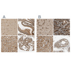 Anti-MRPS22 Antibody