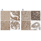Anti-MRPS22 Antibody