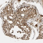 Immunohistochemical staining of human testis shows strong granular cytoplasmic positivity in cells in seminiferous ducts.