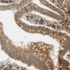 Immunohistochemical staining of human small intestine shows moderate granular cytoplasmic positivity in glandular cells.