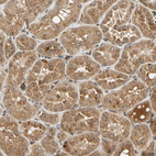 Anti-MRPS22 Antibody