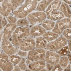 Immunohistochemical staining of human kidney shows moderate granular cytoplasmic positivity in cells in tubules.