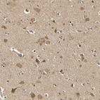 Anti-MRPS22 Antibody