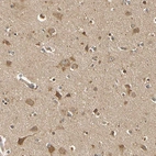 Immunohistochemical staining of human cerebral cortex shows moderate granular cytoplasmic positivity in neurons.