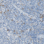 Immunohistochemical staining of human lymphoid tissues shows moderate membranous positivity in lymphoid cells.