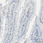 Immunohistochemical staining of human gastrointestinal shows moderate to strong membranous positivity in lymphoid cells.